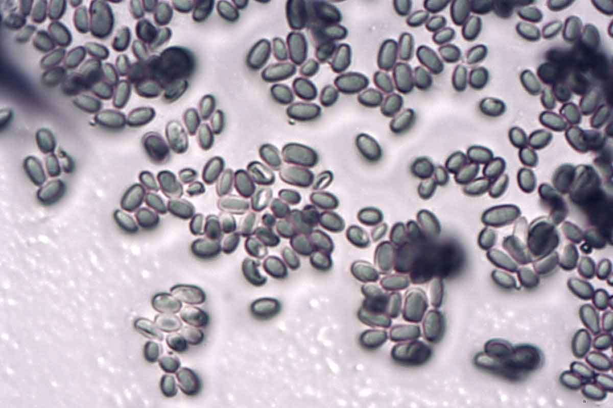 microscopic-mold-spores